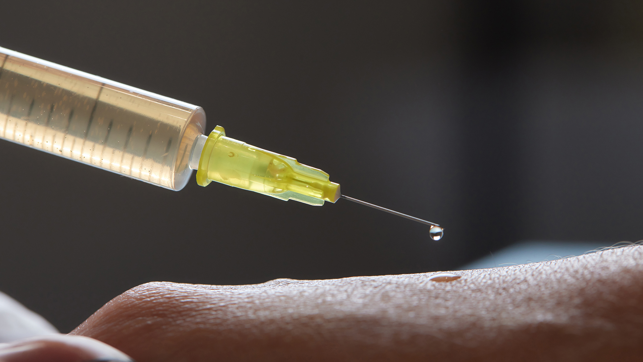 Close-up of a syringe releasing a droplet of fluid onto human skin, symbolizing regenerative medicine and stem cell therapy. The image represents emerging biomedical interventions aiming to restore stem cell function and reverse signs of aging. Would you like a version with more emphasis on specific concepts like epigenetic reprogramming, extracellular vesicles, or clinical translation?