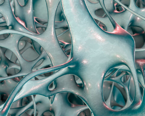 A microscope's view of the bone's trabacular structures, artificially colored in teal and red accents.